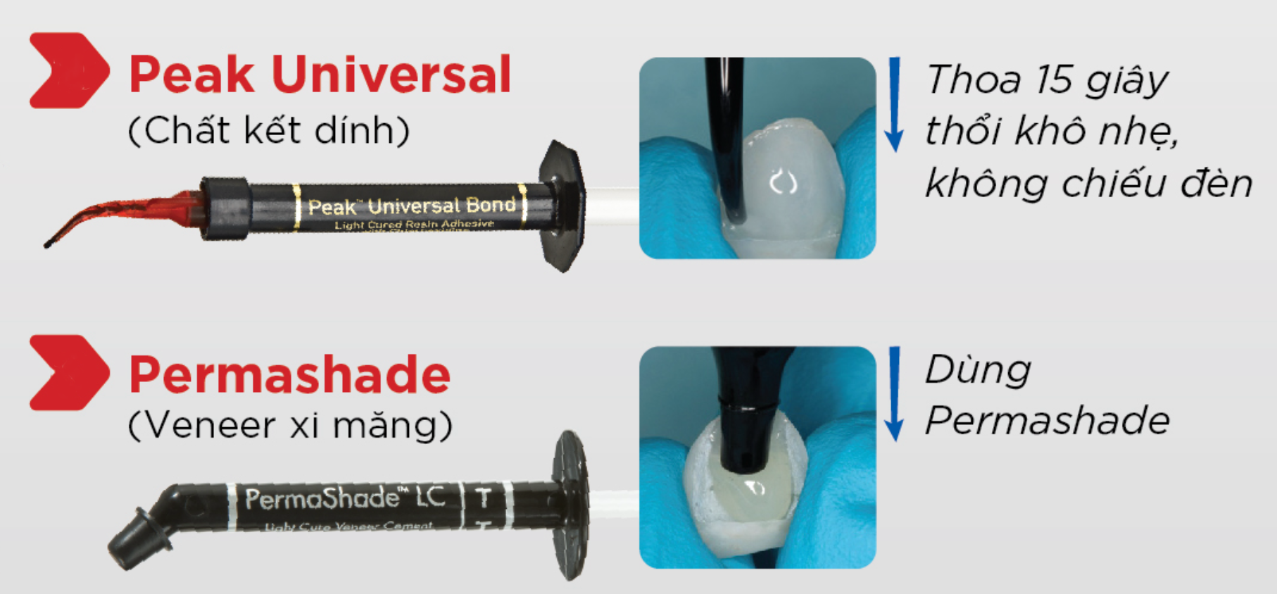 Các bước sử dụng bộ vật liệu gắn mặt dán sứ veneer của hãng Ultradent🌱NHA KHOA MALL🌱